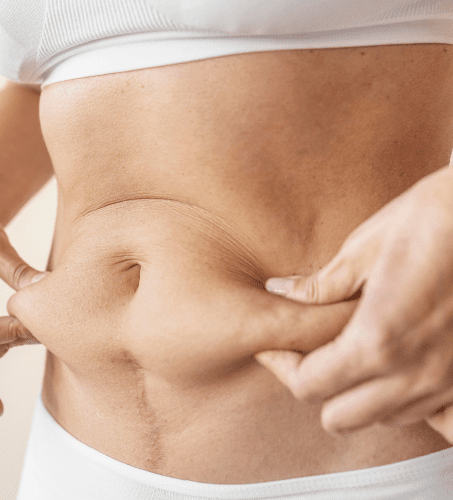 لیپوماتیک شکم در الو جراح