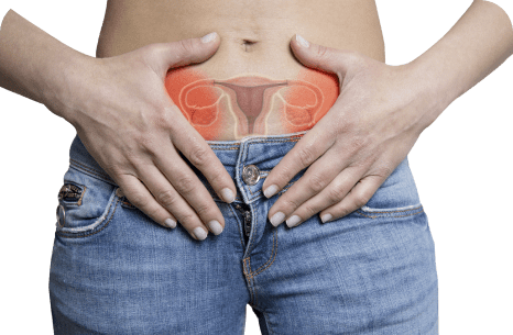 هیسترکتومی