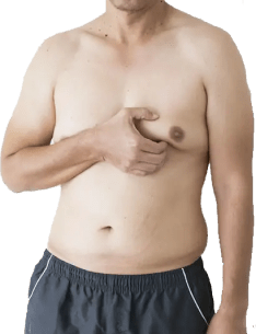 عمل ژنیکوماستی