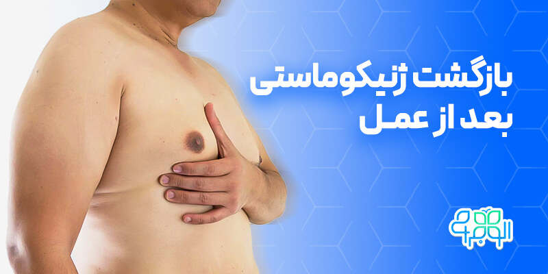 بازگشت ژنیکوماستی بعد از عمل