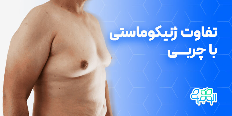 تفاوت ژنیکوماستی با چربی