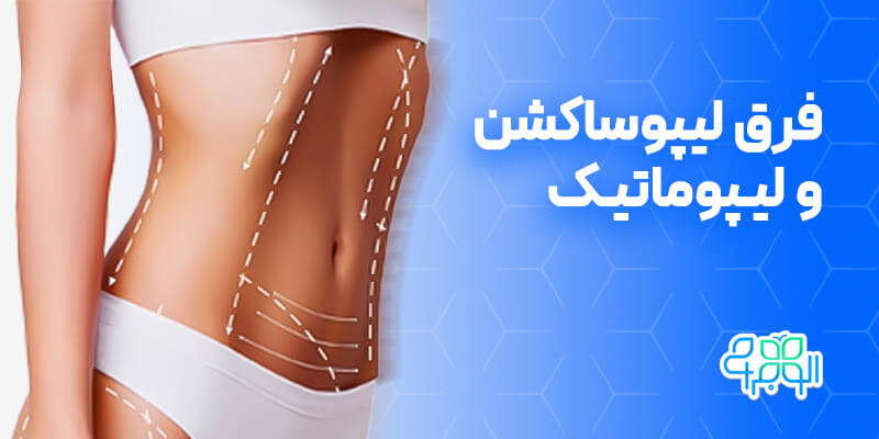 فرق لیپوساکشن و لیپوماتیک