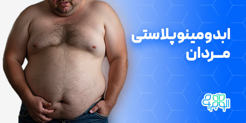 ابدومینوپلاستی مردان (1)