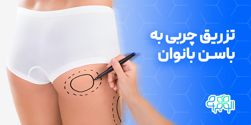 تزریق چربی به باسن بانوان