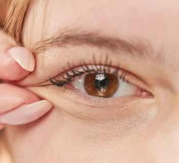 جراحی زیبایی پلک