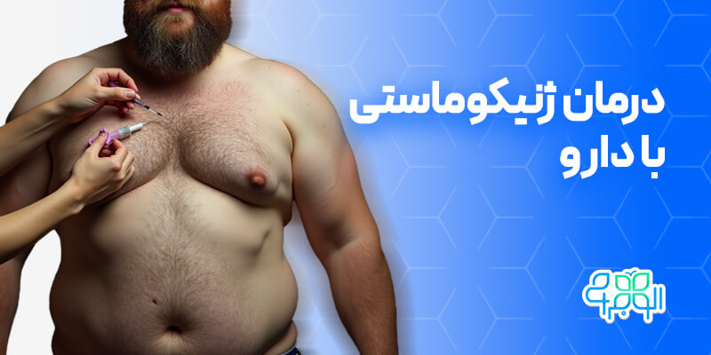 درمان ژنیکوماستی با دارو
