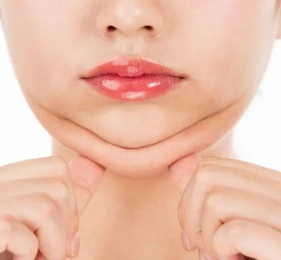 ساکشن غبغب 1