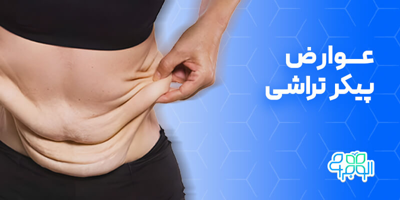 عوارض پیکر تراشی