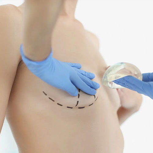 عکس عمل جراحی پروتز پستان