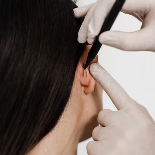 فیلم قبل و بعد اتوپلاستی