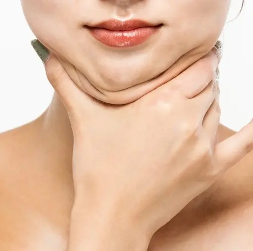 ساکشن غبغب 5