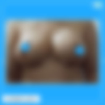 ماموپلاستی عکس 3