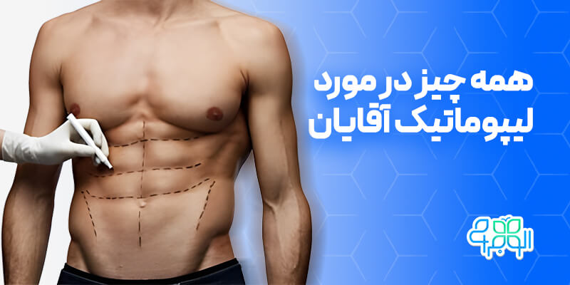 لیپوماتیک آقایان