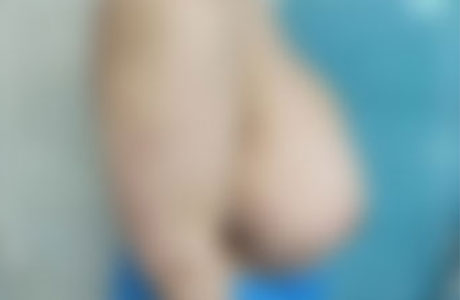 ماموپلاستی در الو جراح توسط دکتر مرادیان