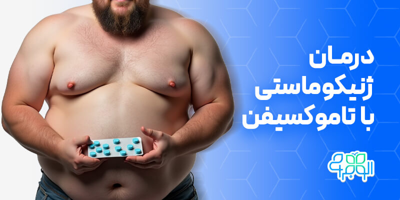 درمان ژنیکوماستی با تاموکسیفن