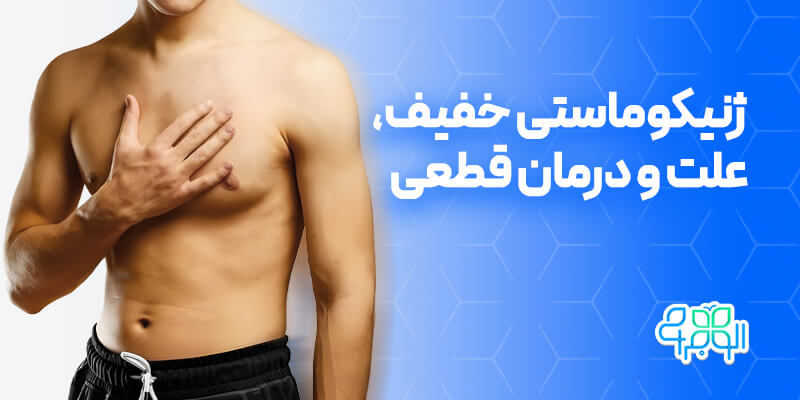 ژنیکوماستی خفیف