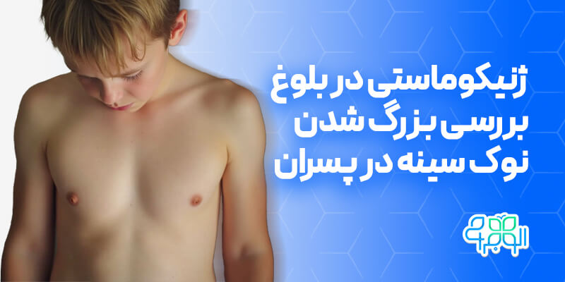 ژنیکوماستی در بلوغ
