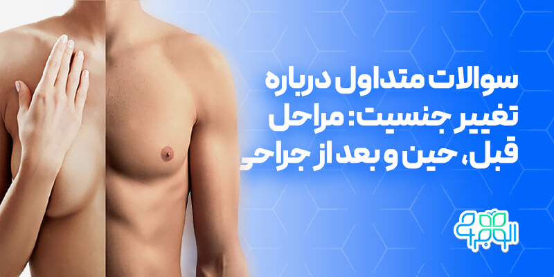 پرسش و پاسخ درباره تغییر جنسیت