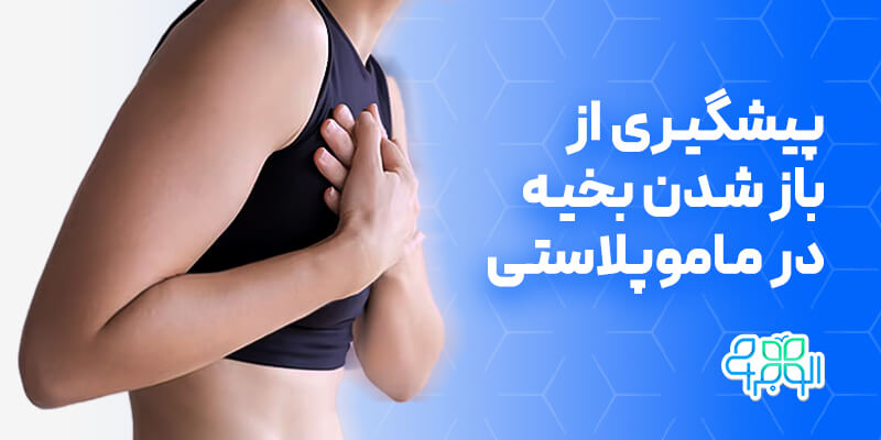 باز شدن بخیه در ماموپلاستی