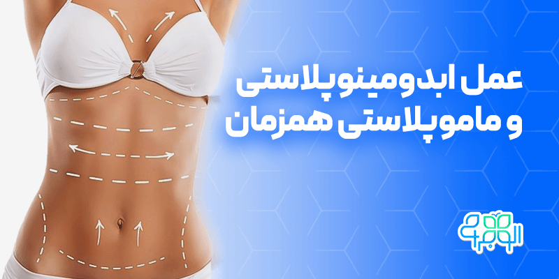 ابدو و مامو همزمان