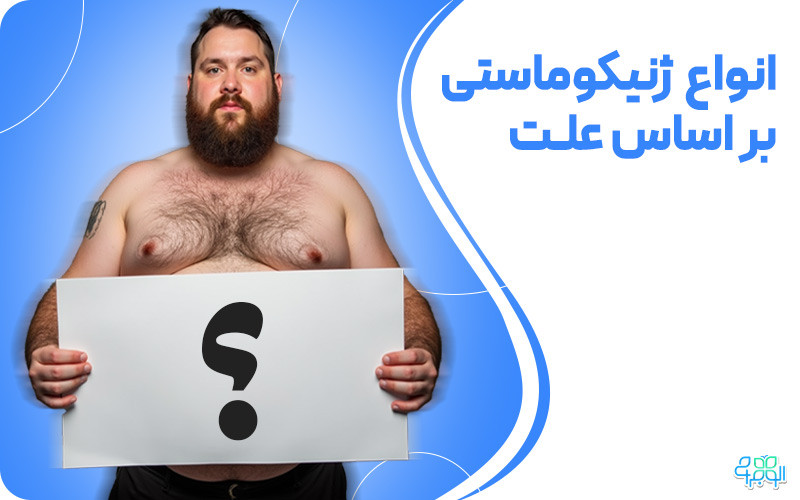 انواع ژنیکوماستی بر اساس علت
