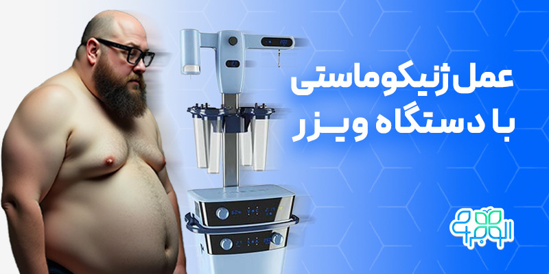 عمل ژنیکوماستی با دستگاه ویزر